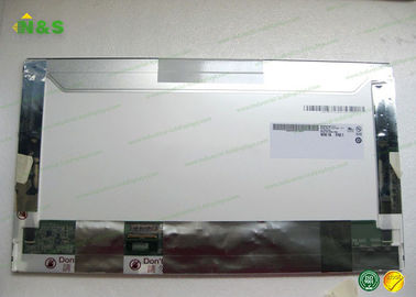 FHD M215HW01 V0デスクトップのモニターのパネルのための21.5インチのauo LCDの表示